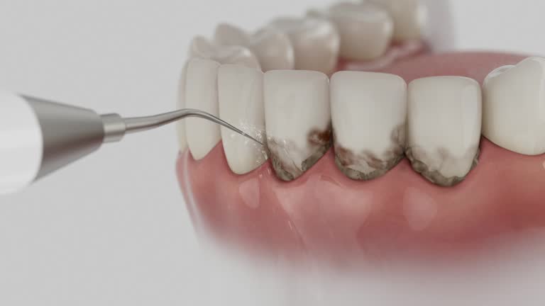 Reliable Dental contractor in Steamboat Springs, CO by Dentist Open Now